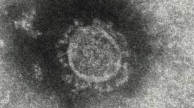 新型コロナウイルス、東京で2000人超感染 過去最多