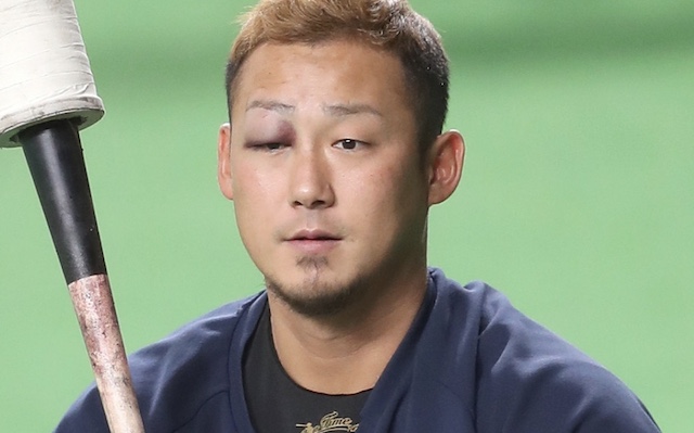 【話題】中田翔選手がやらかした時、めちゃくちゃ荒れてたWikipediaがこちら…