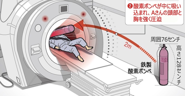 【韓国】MRIが磁力で酸素ボンベを吸い込む → 検査中の患者が挟まれ死亡