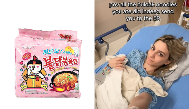 韓国ラーメン『ブルダック炒め麺』を半年間、毎週食べて血尿… ２０代アメリカ女性、腎臓結石で病院へ