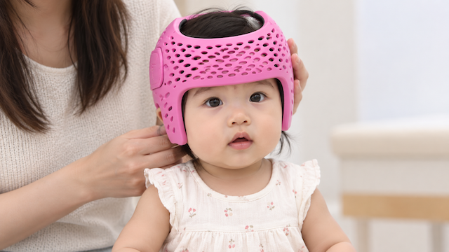 赤ちゃんに60万円のヘルメットをつけて矯正する「頭の形外来」が大人気！